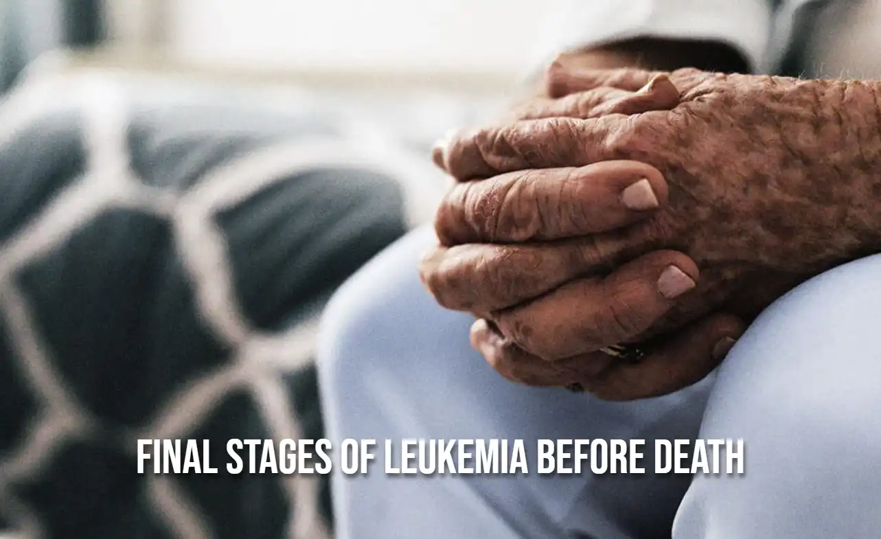 Final Stages of Leukemia Before Death