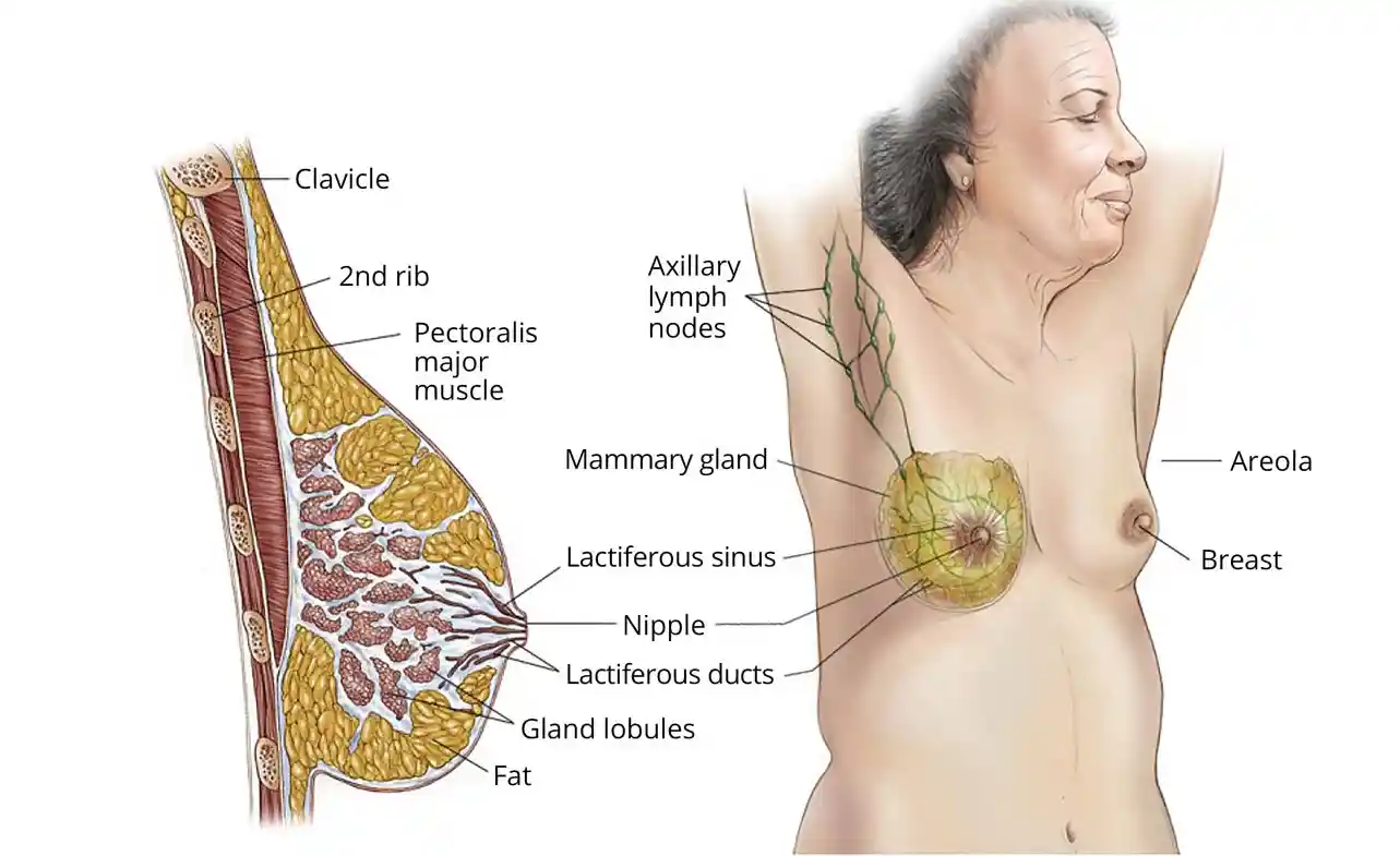 Is Stage 3 Breast Cancer Curable