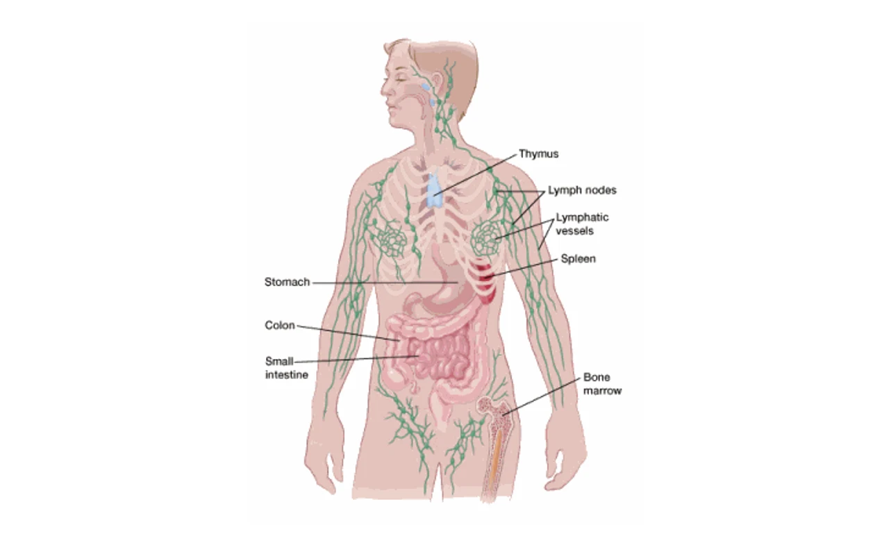Stage 4 Cancer Lymph Nodes: Symptoms, Diagnosis, Treatment