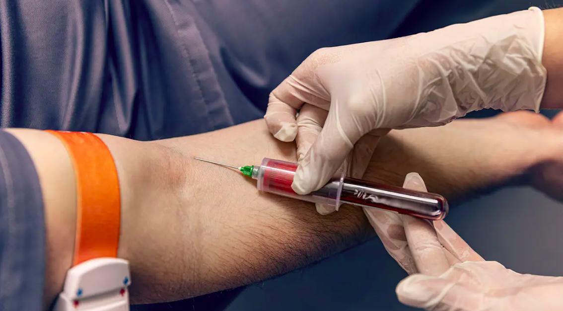 Blood Test for Pancreatic Cancer: Causes and Risk Factors