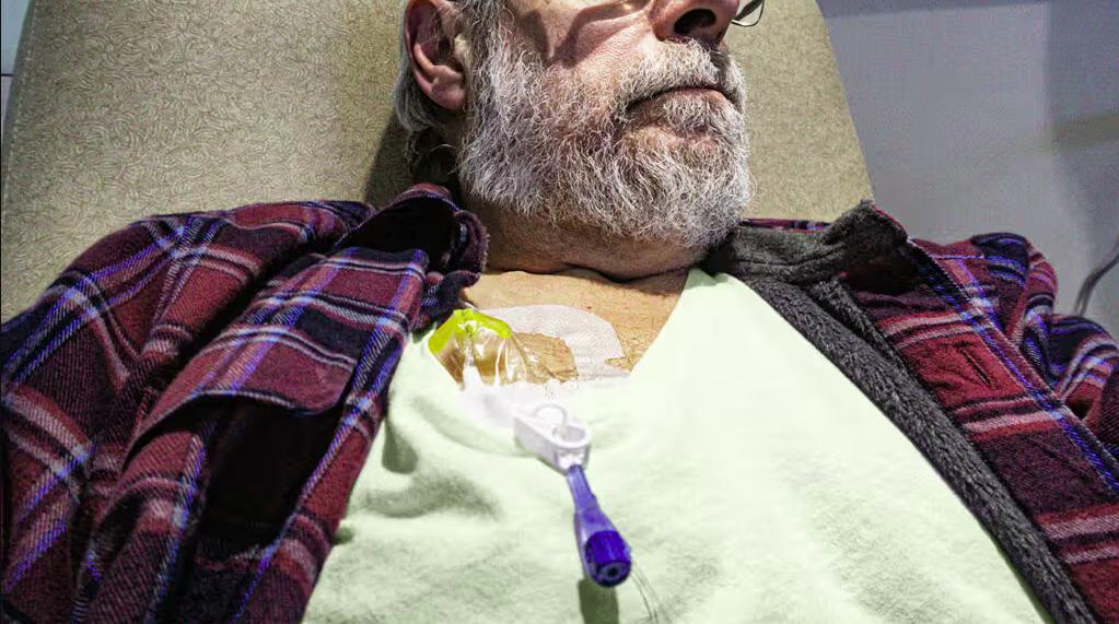 Colon Cancer Spread to Liver Life Expectancy: Causes and Risk Factors