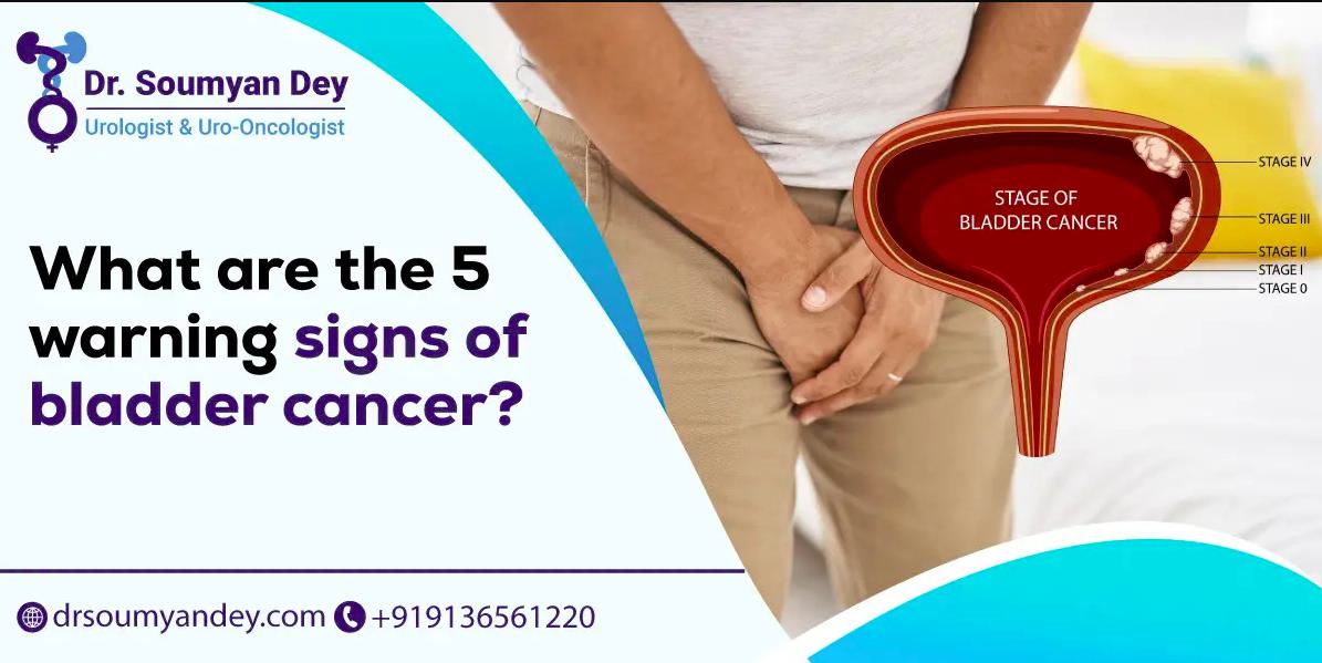 Early Signs of Bladder Cancer: Causes and Risk Factors