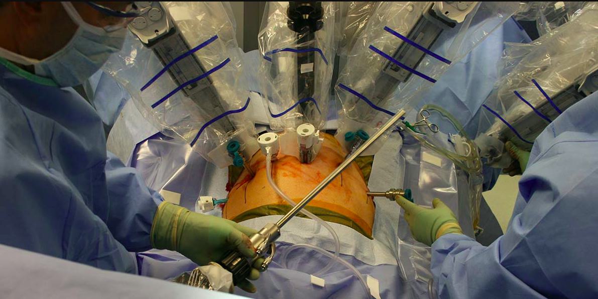 Robotic Surgery for Prostate Cancer: Causes and Risk Factors