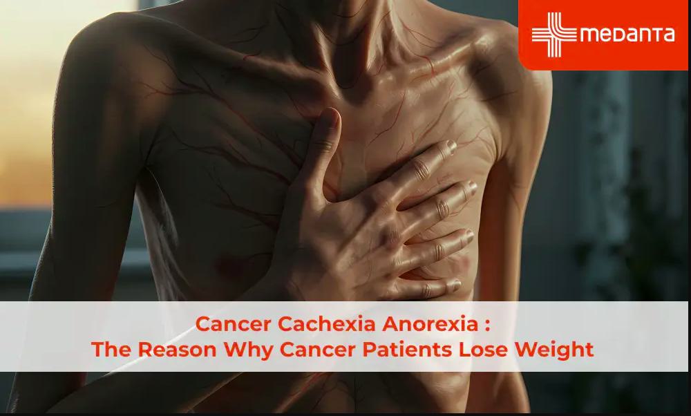 Why Do Cancer Patients Lose Weight? Causes and Risk Factors